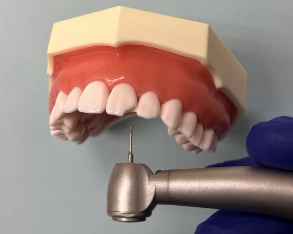 Dental bur used to prepare space for DentXpin.